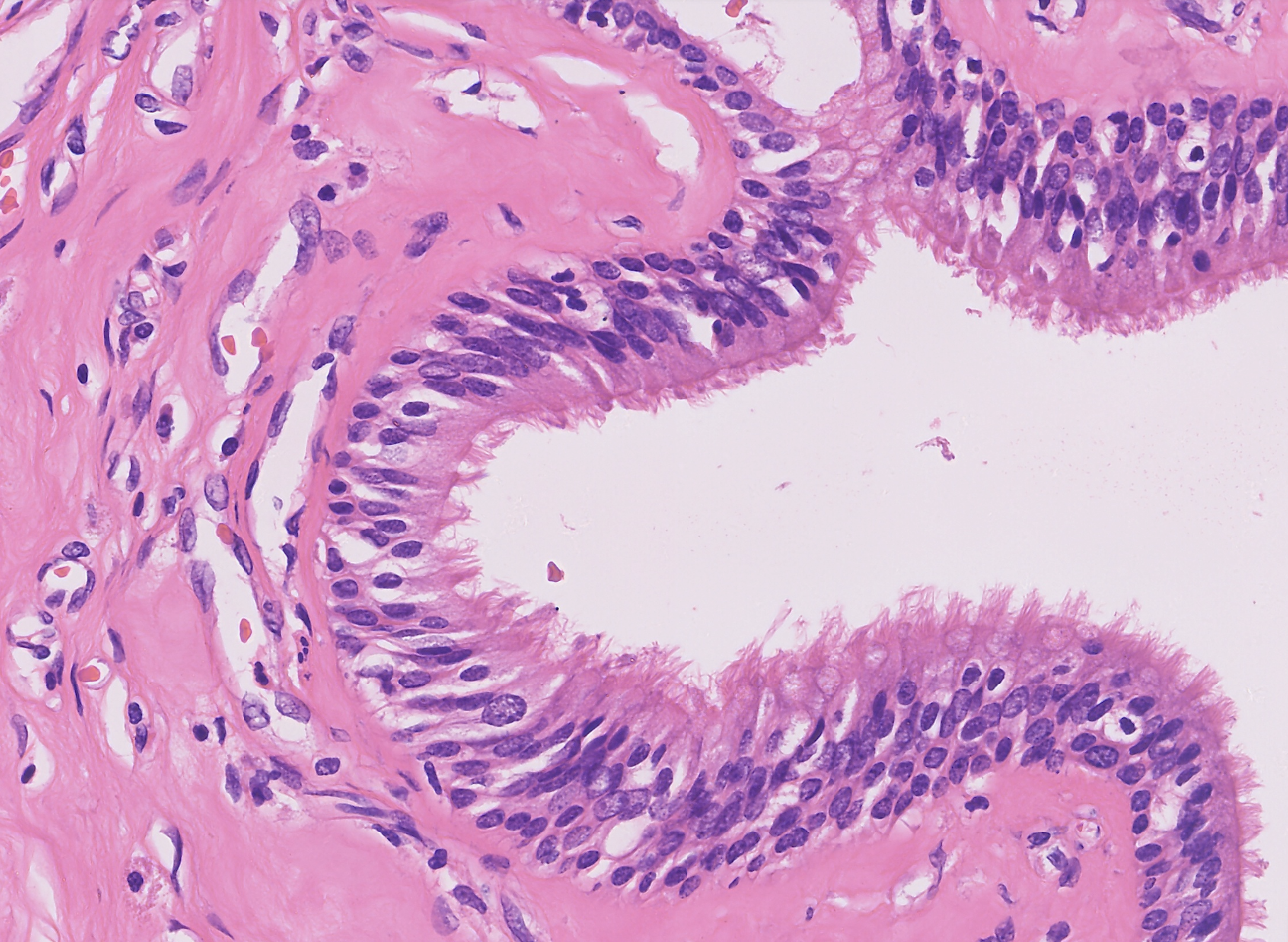 Nasal mucosa thumbnail